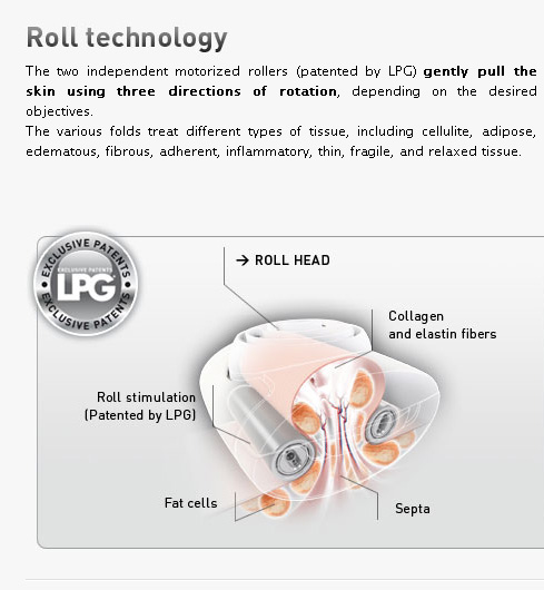 Endermologie Roll Technology Cleveland OH